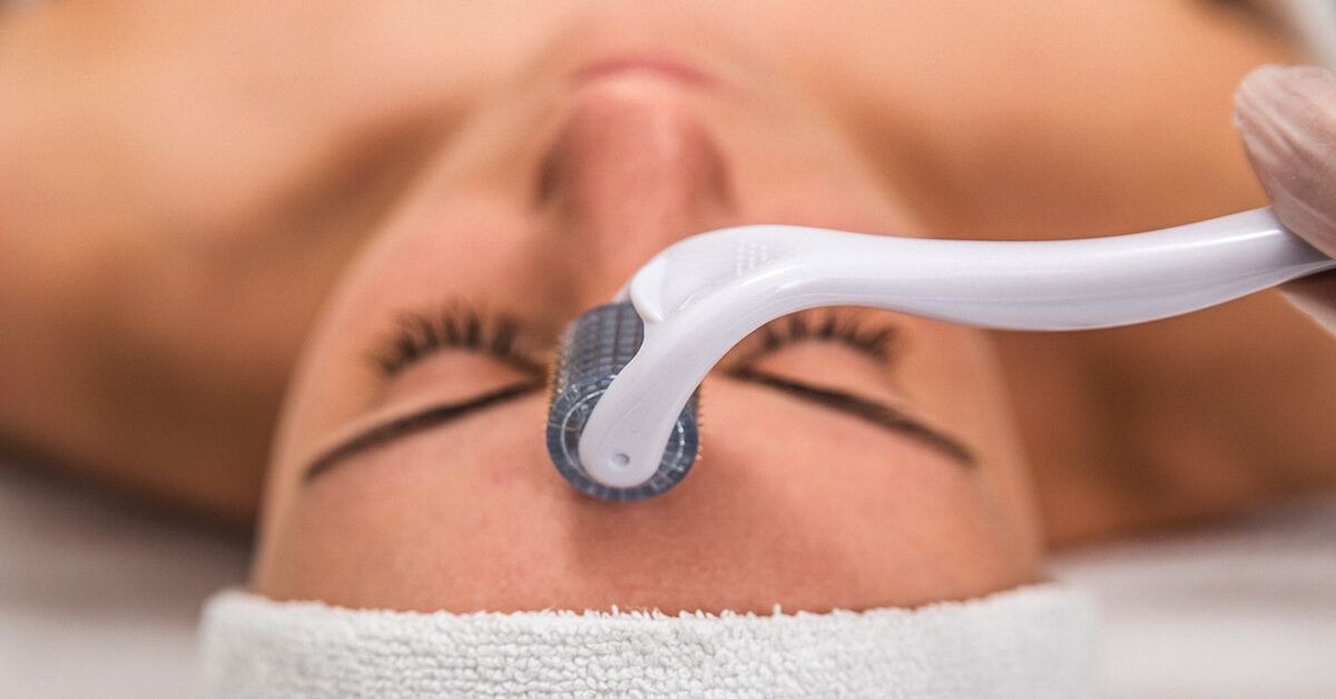A close-up of a woman receiving a facial treatment with a dermaroller on her forehead, relaxing with eyes closed.